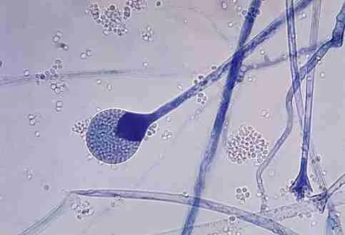 Mucormycosis is a serious but rare fungal infection caused by a group of molds called mucormycetes.