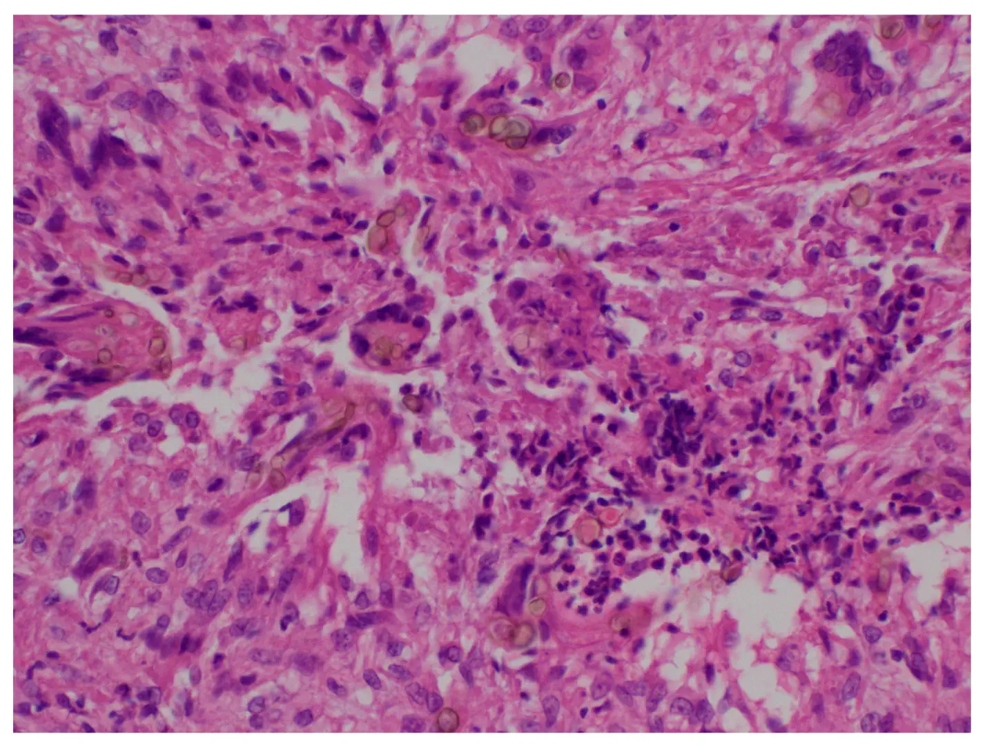 Phaeohyphomycetes